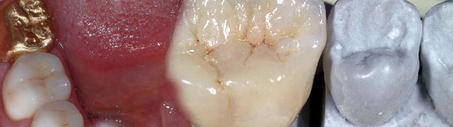 Prosthodontics 